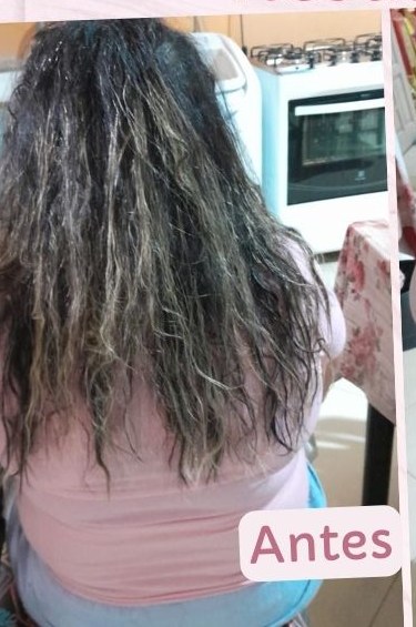 Antes 2